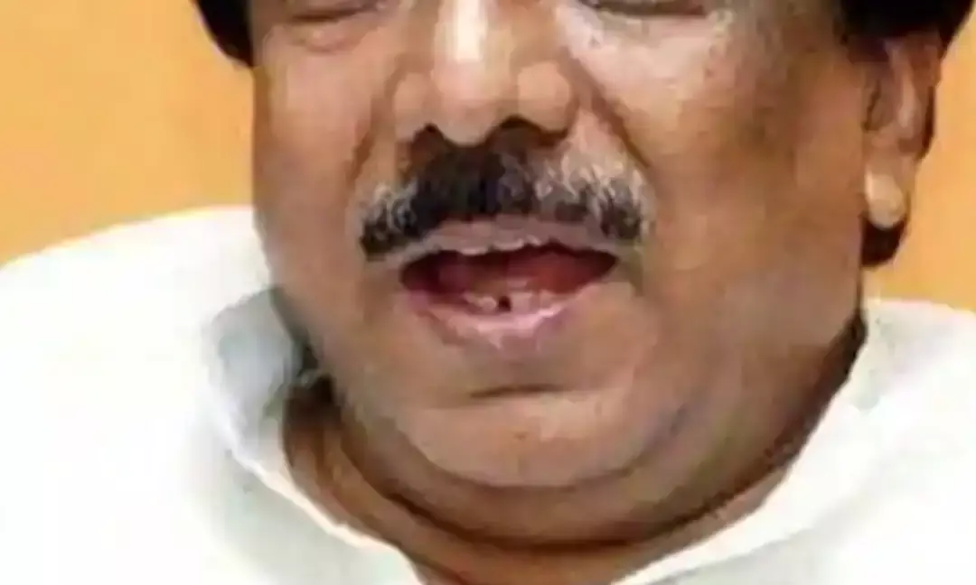 When They Are Out Of Power, They Play The M Card