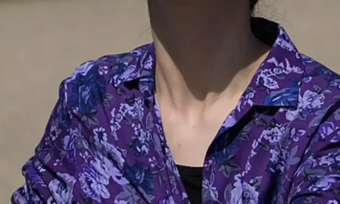 People Who Saw The Eclipse Are Visiting The Doctor