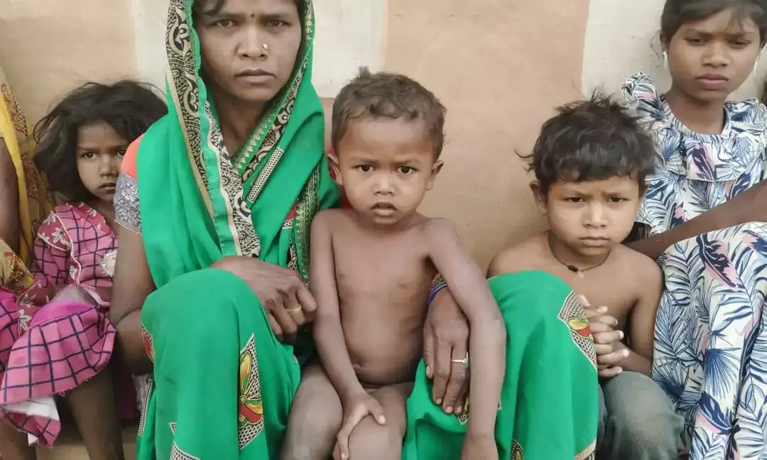 Malnutrition in Palamu: झारखंड के अनुसूचित जाति के बच्चे आख़िर क्यों हैं कुपोषण के अधिक शिकार