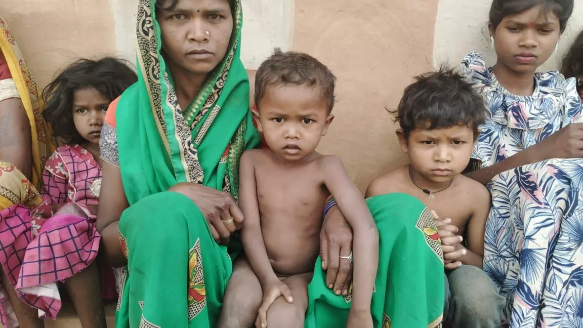 Malnutrition in Palamu: झारखंड के अनुसूचित जाति के बच्चे आख़िर क्यों हैं कुपोषण के अधिक शिकार Malnutrition in Palamu: झारखंड के अनुसूचित जाति के बच्चे आख़िर क्यों हैं कुपोषण के अधिक शिकार